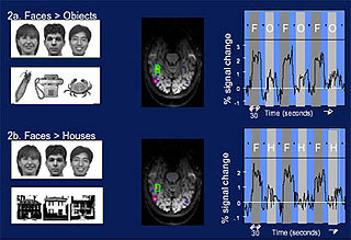 Comparison of sample fMRI scans of the brains of subjects.